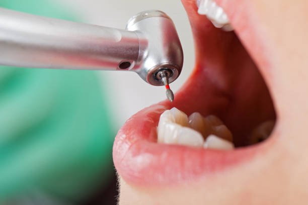 Best Emergency Dental Surgery in Campti, LA